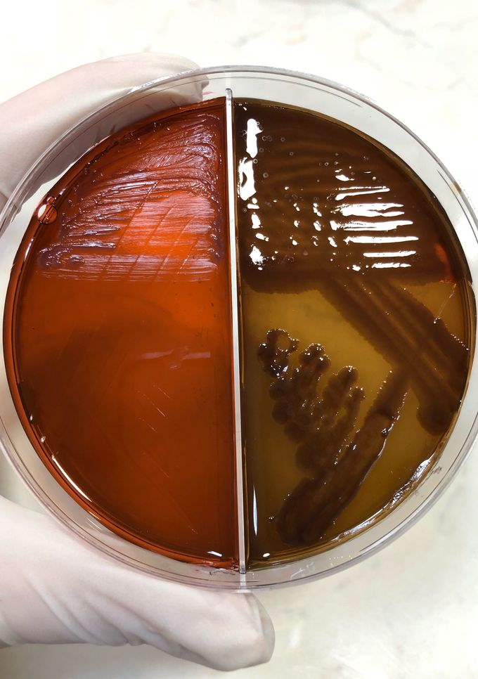 Pseudomonas aeruginosa on EMB and blood agar