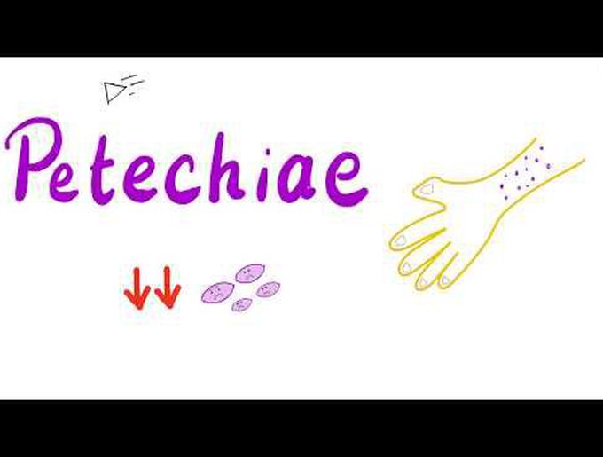 Petechiae Suncutaneous Hematoma | Forensic Medicine