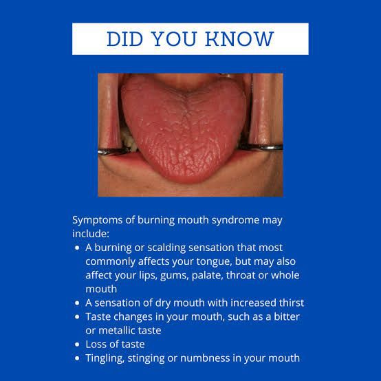 Symptoms of burming mouth syndrome MEDizzy