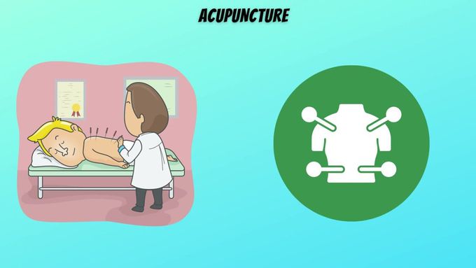 ACUPUNCTURE For Lower Back Pain