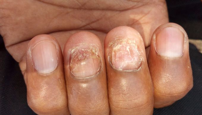 Tell me disease