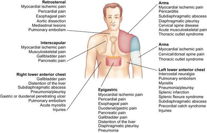 Chest Pain Differential Diagnosis