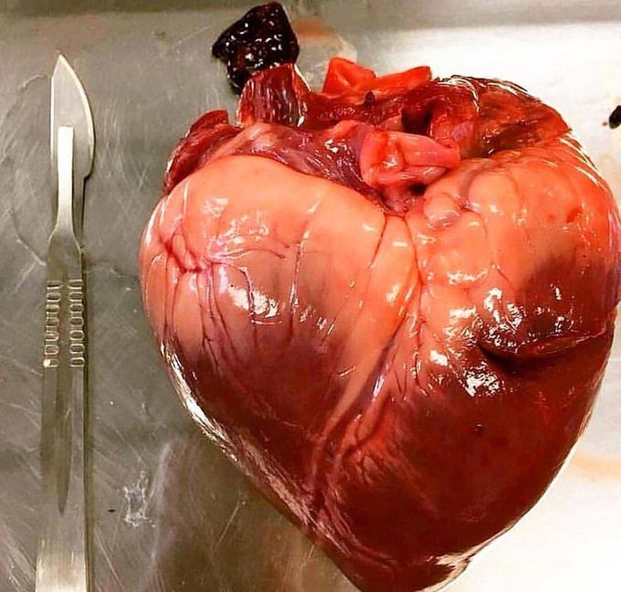 Human heart