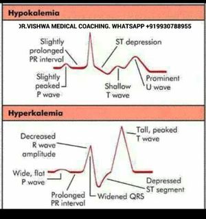 Hypokalemia and hyperkalemia - MEDizzy