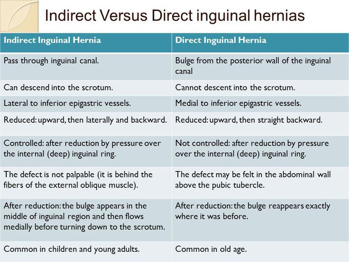 Differences between indirect and direct inguinal hernias