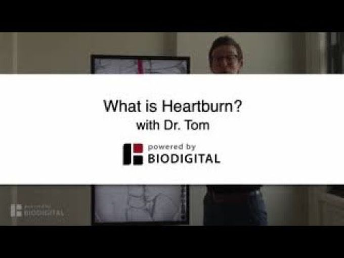 What is Heartburn?