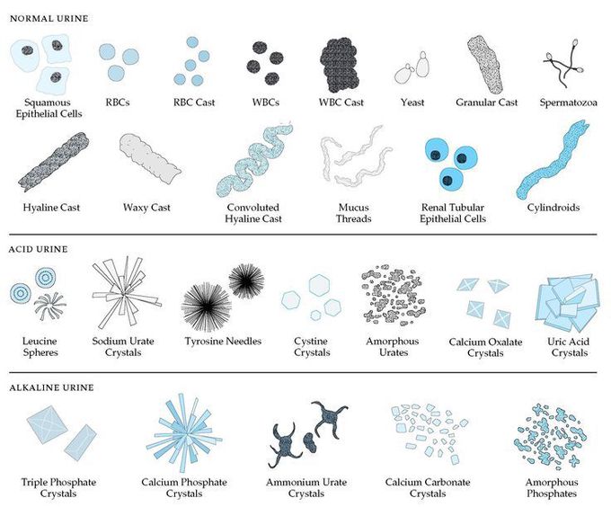 Components of Urinary Sediment