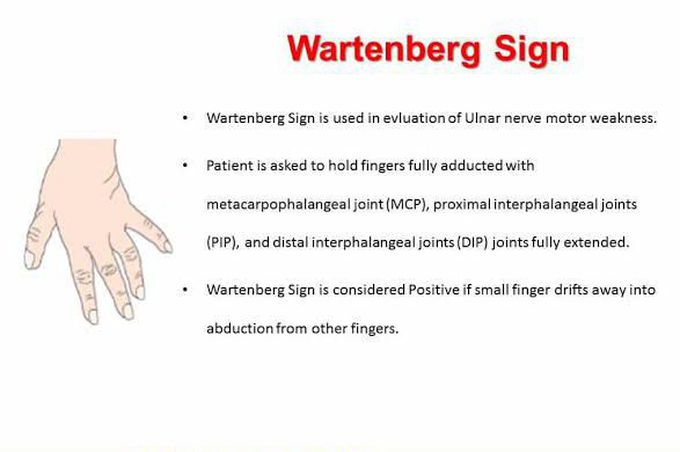 These are the symptoms of Wartenburgs syndrome