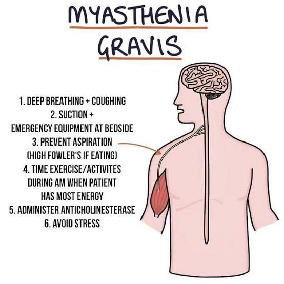Myasthenia Gravis Causes Symptoms Treatment Nurses Note Link 👇