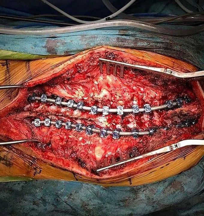 orthopedic surgery