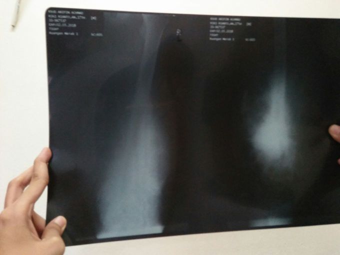 What is your diagnosis?