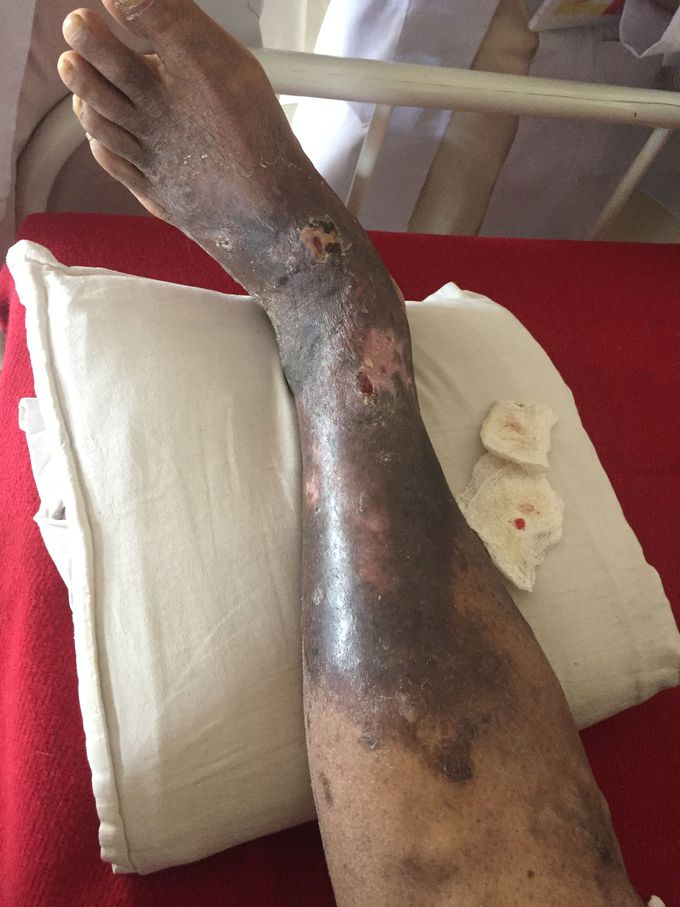 Surgery case