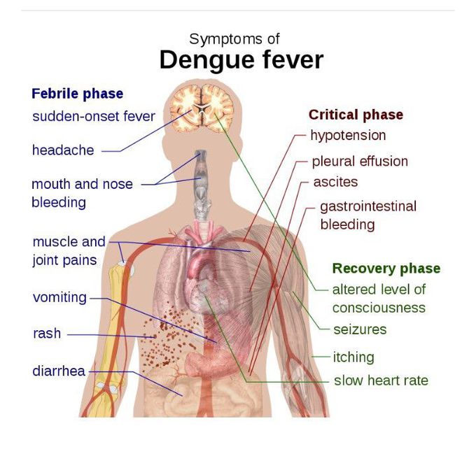 Symptoms of Dengue fever