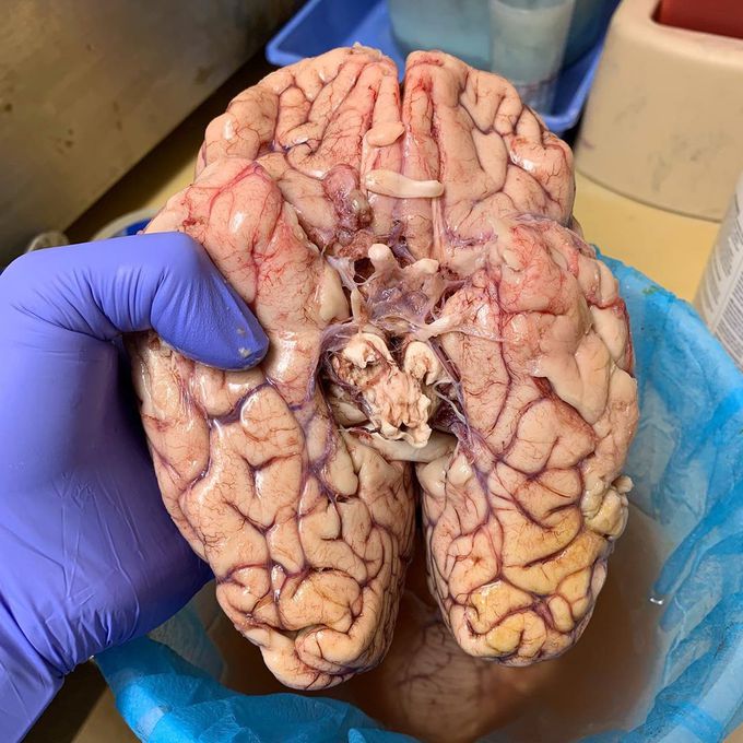 Bottom/inferior view of the brain!!