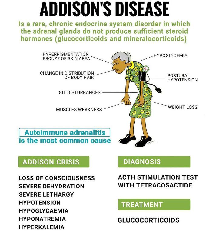 Addison's Disease