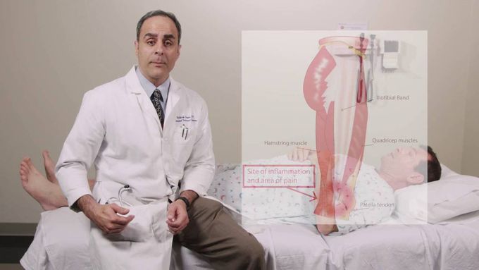 Iliotibial Band Syndrome Physical Exam - Stanford Medicine 25