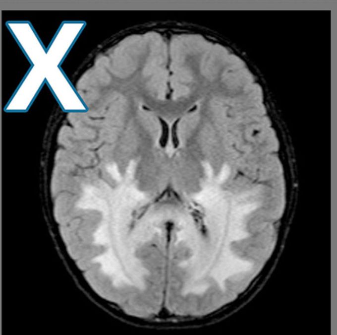 Neuroradiology