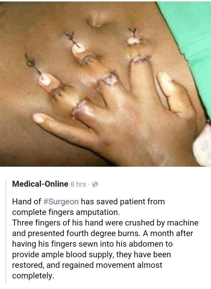 Surgery