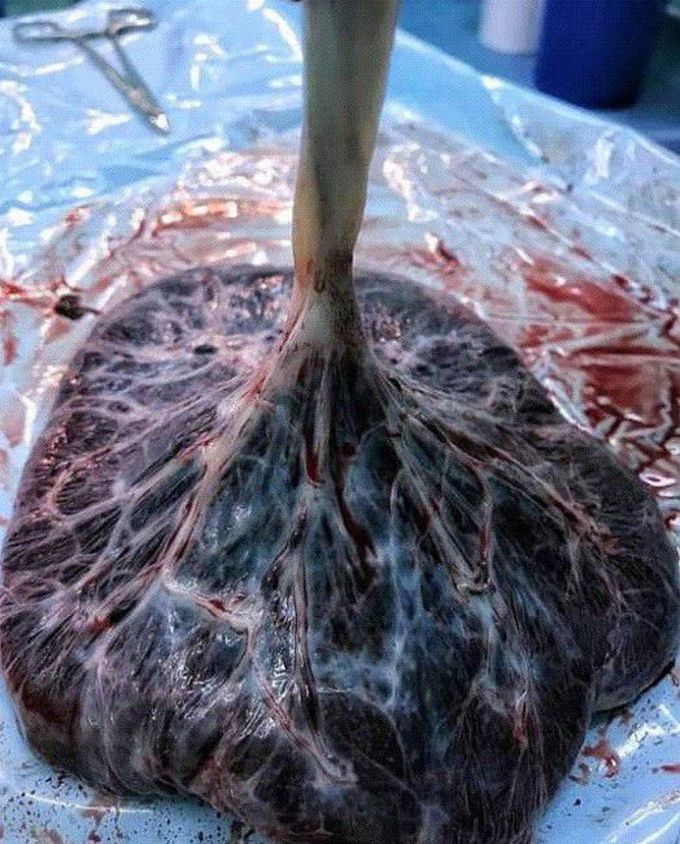 The root of life