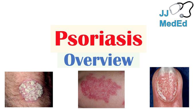 Pathology of Psoriasis