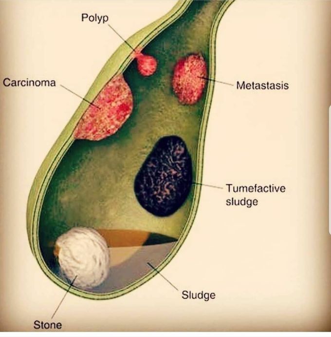 Gall bladder