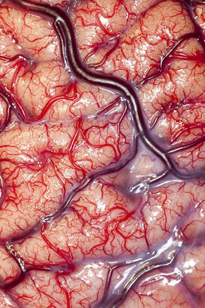 brain