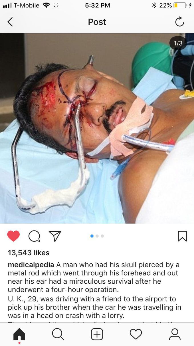 This is so interesting and so scary but medicalstuff for life 💯💯💯