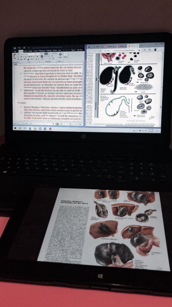 Biliary system