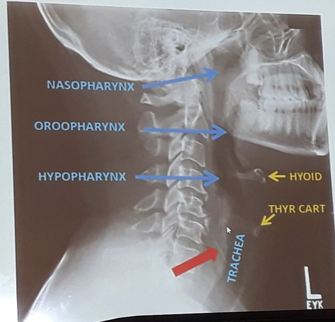 Neck structures