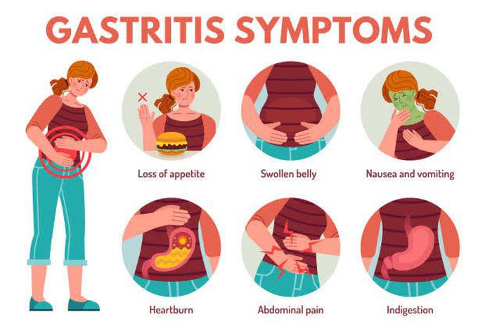 Gastritis MEDizzy   5389d863 6cbf 4a4f 89d8 636cbf8a4f1e