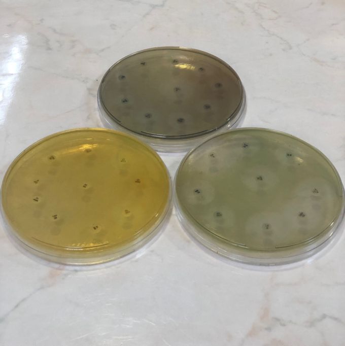 3 different colour pigmentations of Pseudomonas aeruginosa on Mueller-Hinton agars