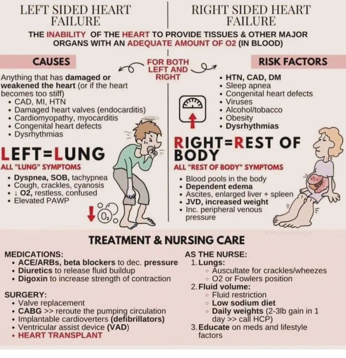 Left Sided Vs Right Sided Heart Failure