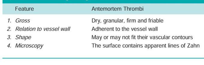 Antemortem Thrombi