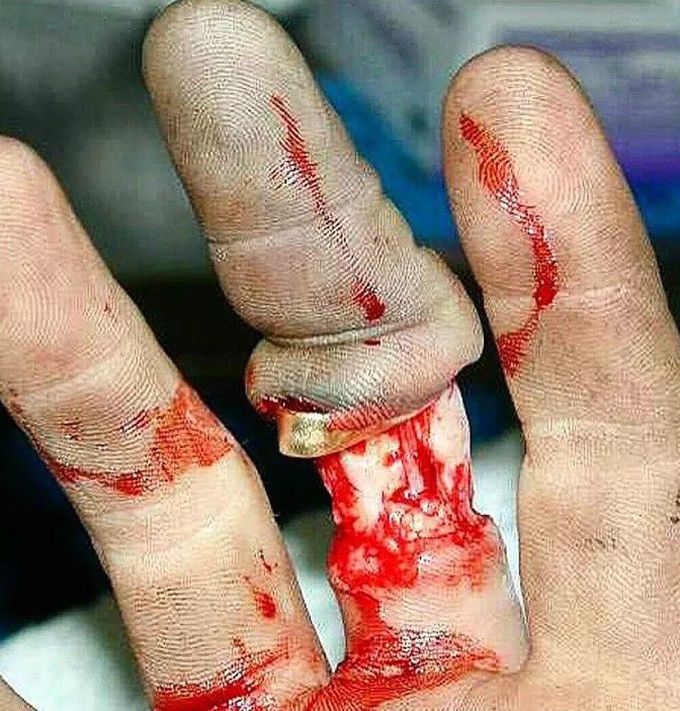 orthopedic surgery