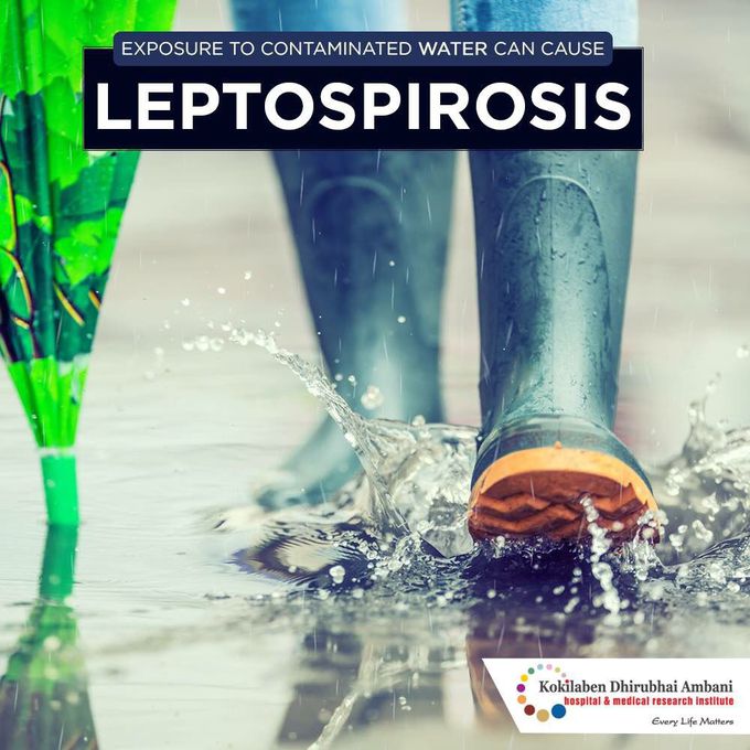 LEPTOSPIROSIS