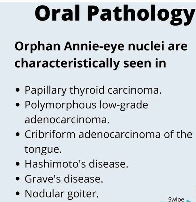 Orphan Annie-eye Nuclei