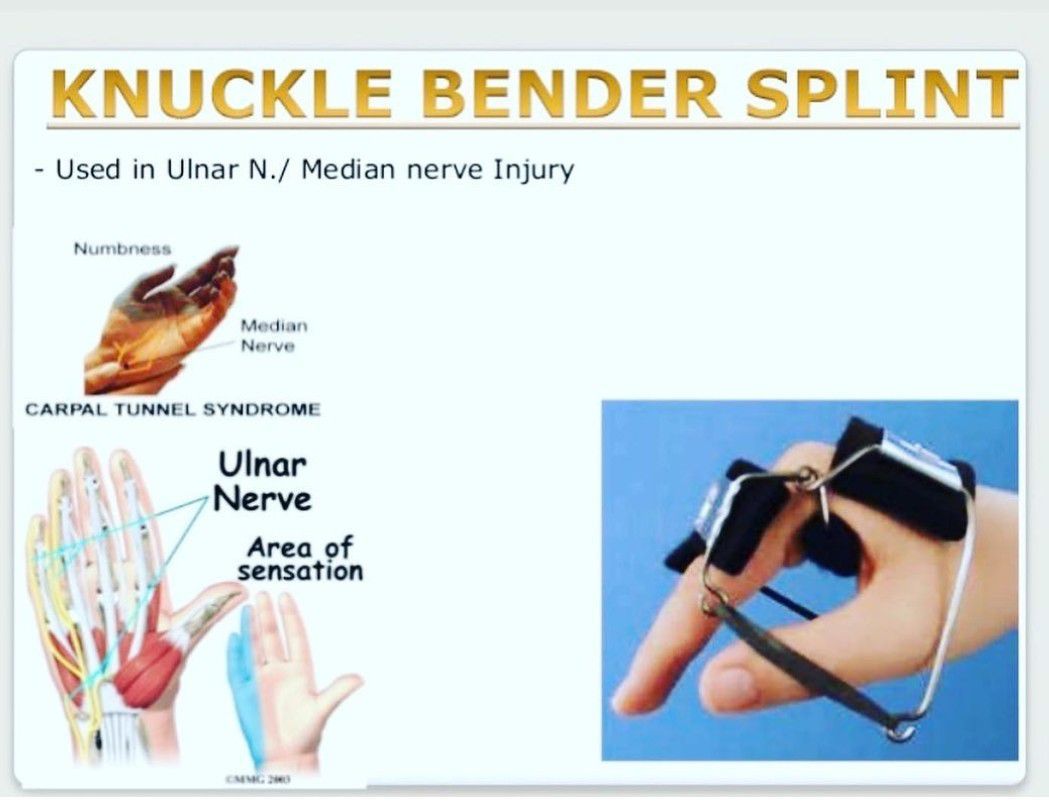 Knuckle Bender Splint - MEDizzy