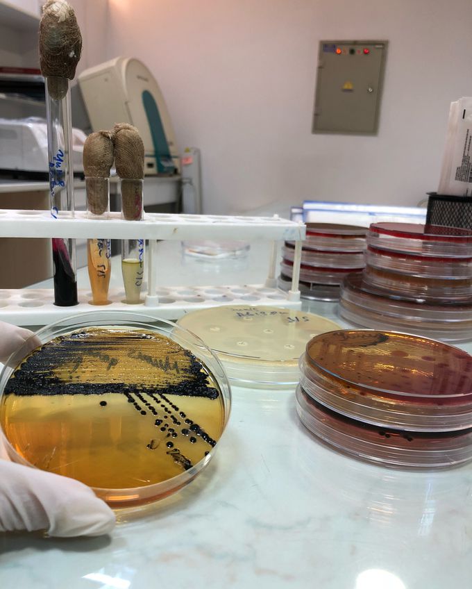 Salmonella group on SS agar