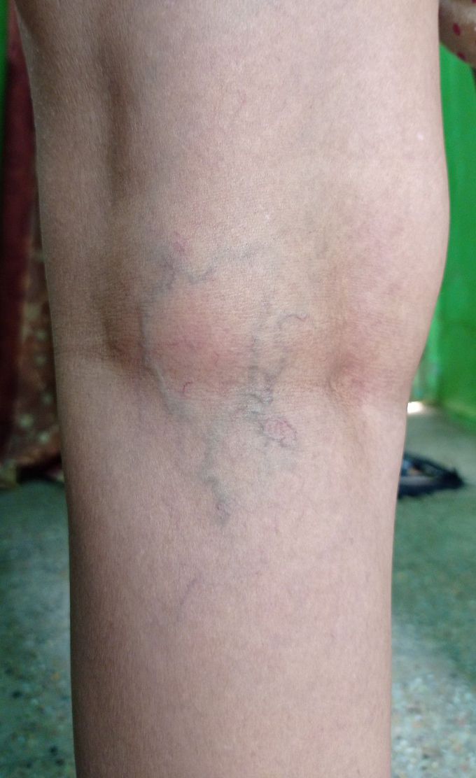 Diagnosis and treatment?