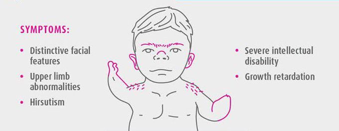 these-are-the-symptoms-of-cornelia-de-lange-syndrome-medizzy