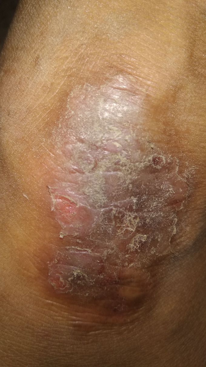 Tell me your diagnosis and treatment