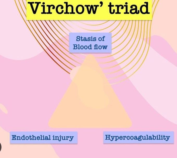 Virchow's Triad