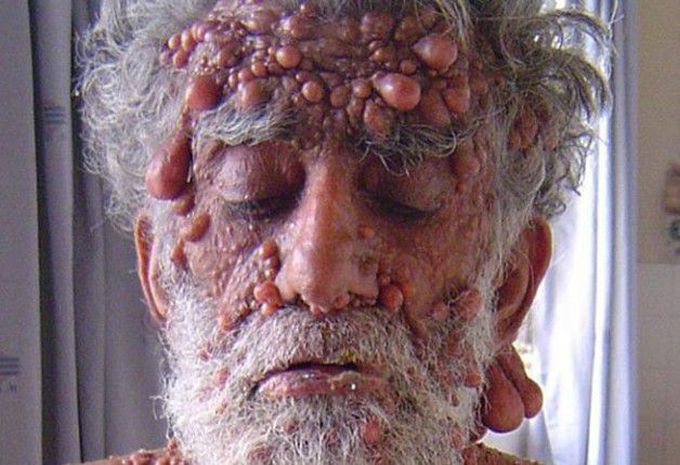 Diagnosis?