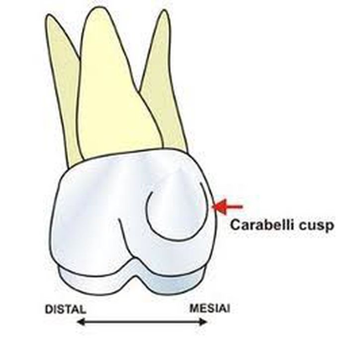 Cusp of Carabelli