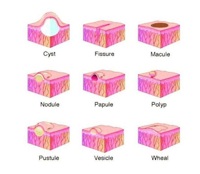 These occur in the beginning of the disease process