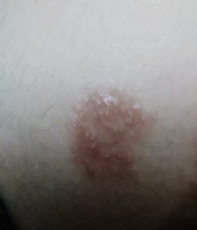 need immediate diagnosis