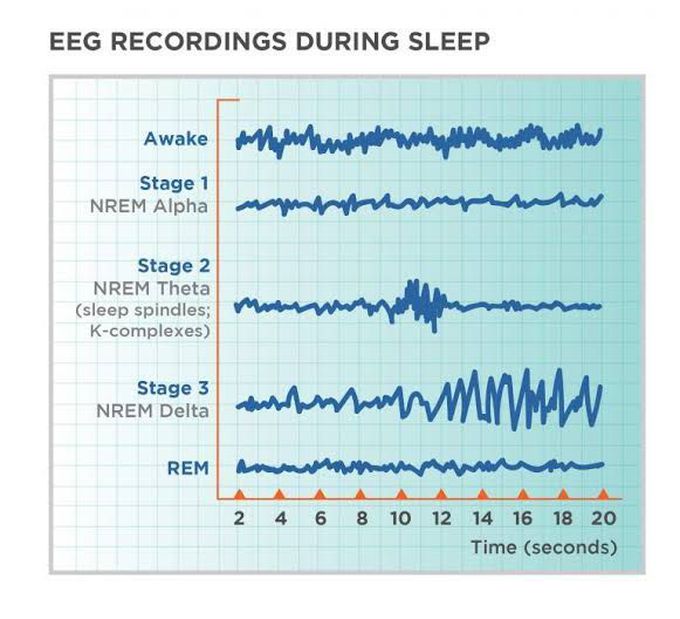 Brain waves during sleeping.