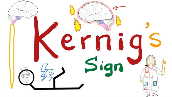 Kernig's Sign | Meningitis