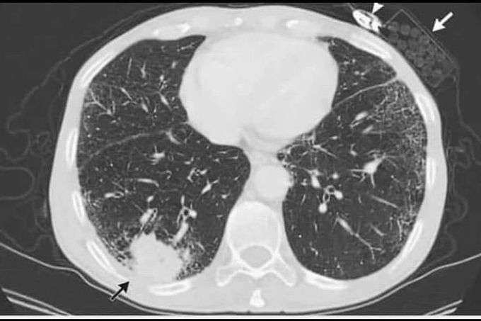 What is your diagnosis??