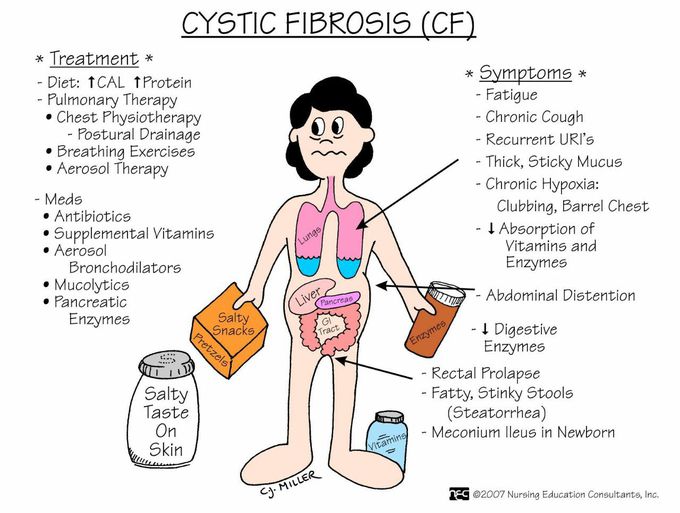 Cystic fibrosis